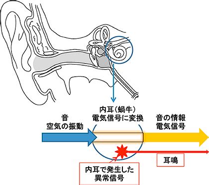 耳鳴 時間|耳鳴りとは？代表的な原因や症状、治療法、受診のタ。